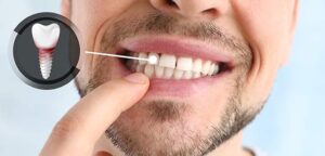 ما هي مخاطر ومضاعفات زراعة الأسنان؟