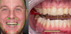 كيف يؤثر ترتيب الأسنان على شكل وملامح الوجه؟